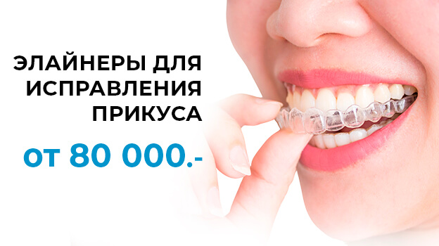 Акция - Лечение кариеса за 2 500!