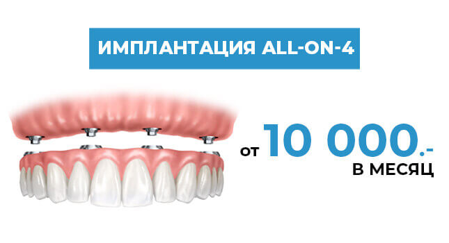 Акция - SPA полости рта за 2 500!
